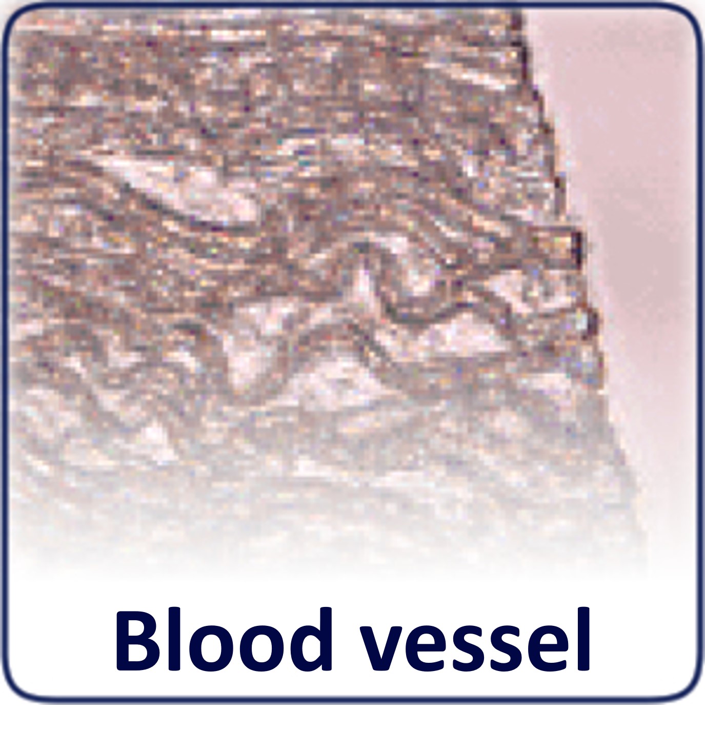 Blood vessel