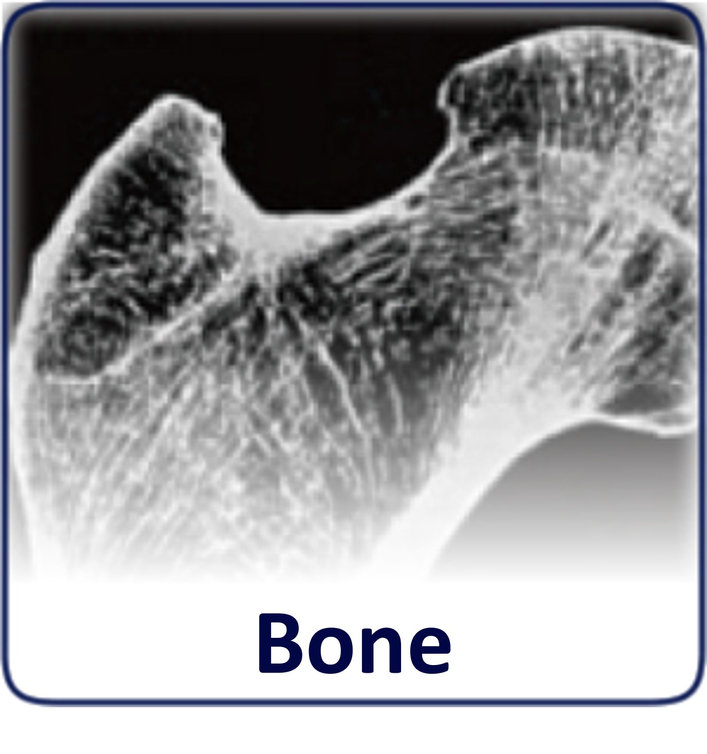 Bone